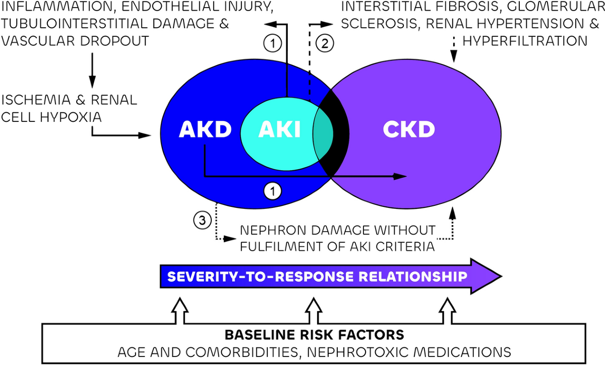 How to Prevent Acute Kidney Injury: Expert Tips