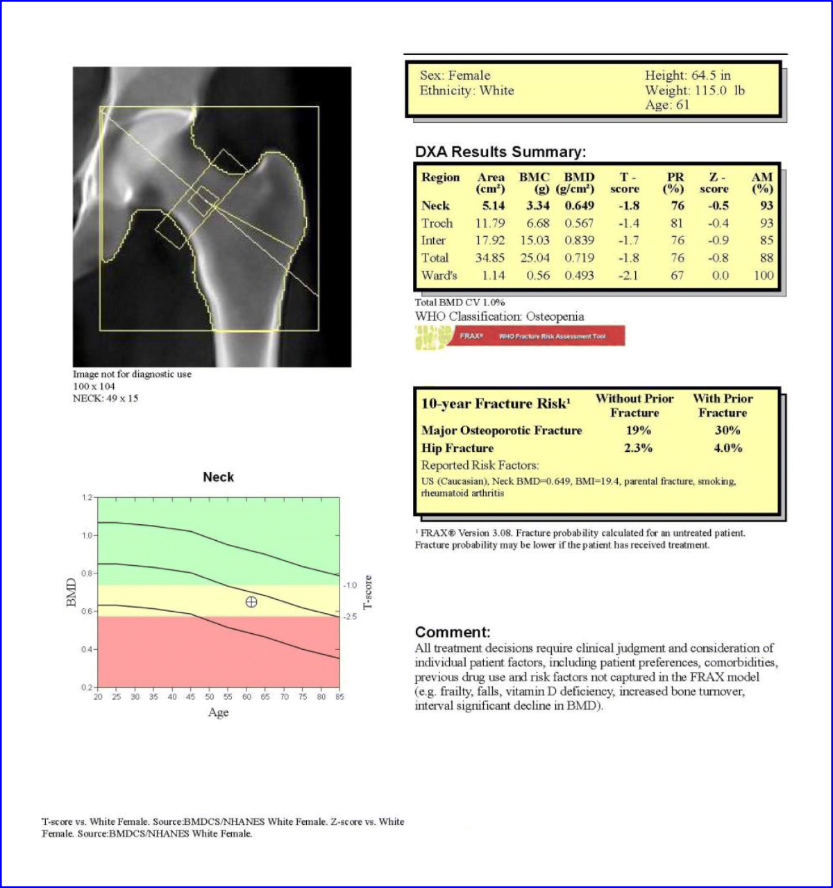 The clinician's guide to prevention and treatment of osteoporosis