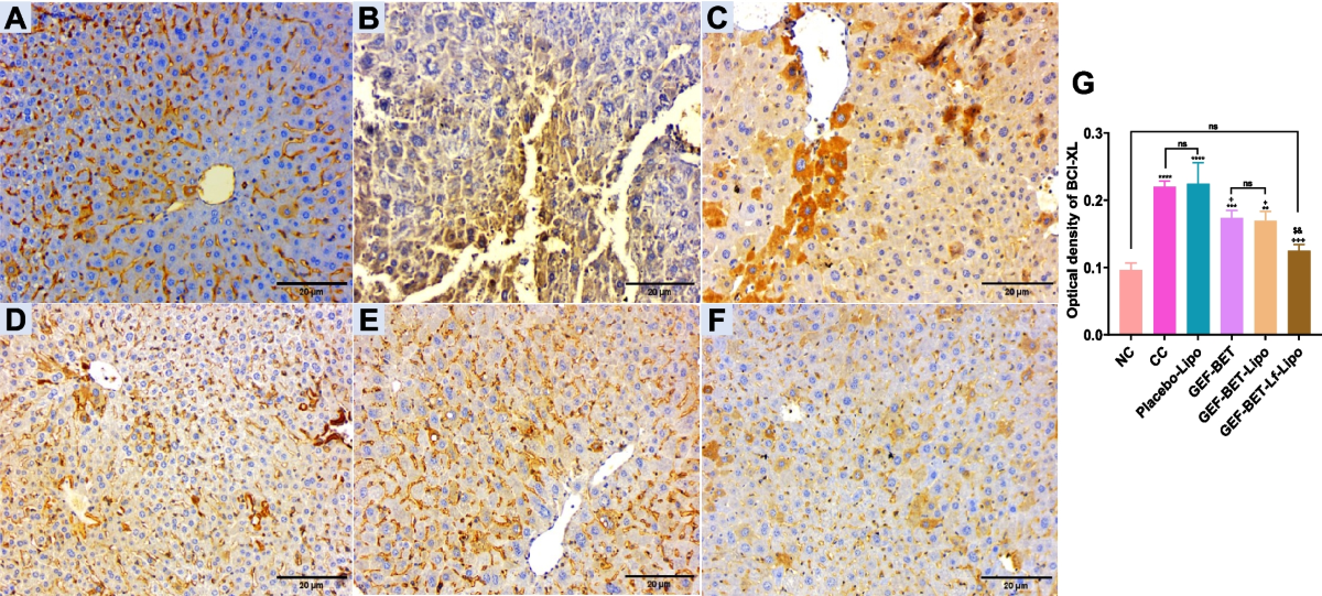 Preclinical evaluation of gefitinib and betulin-loaded surface functionalized liposomes for the treatment of hepatocellular carcinoma via asialoglycoprotein receptor targeting | Naunyn-Schmiedeberg's Archives of Pharmacology | Springer Nature Link Preclinical evaluation of gefitinib and betulin-loaded surface functionalized liposomes for the treatment of hepatocellular carcinoma via asialoglycoprotein receptor targeting | Naunyn-Schmiedeberg's Archives of Pharmacology | Springer Nature Link