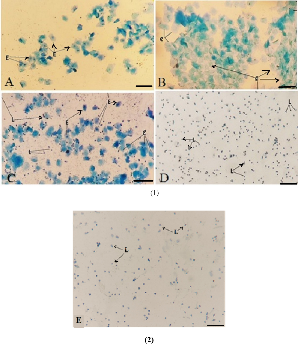 l carnitine increase estrogen L-carnitine improves polycystic ovary syndrome by increasing CYP11A1,  estrogen receptor, and decreasing XNIP and VEGF expression |  Naunyn-Schmiedeberg's Archives of Pharmacology