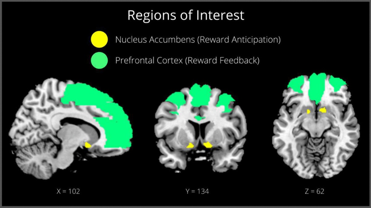 Light Cannabis Use and the Adolescent Brain: An 8-years Longitudinal  Assessment of Mental Health, Cognition, and Reward Processing |  Psychopharmacology | Springer Nature Link