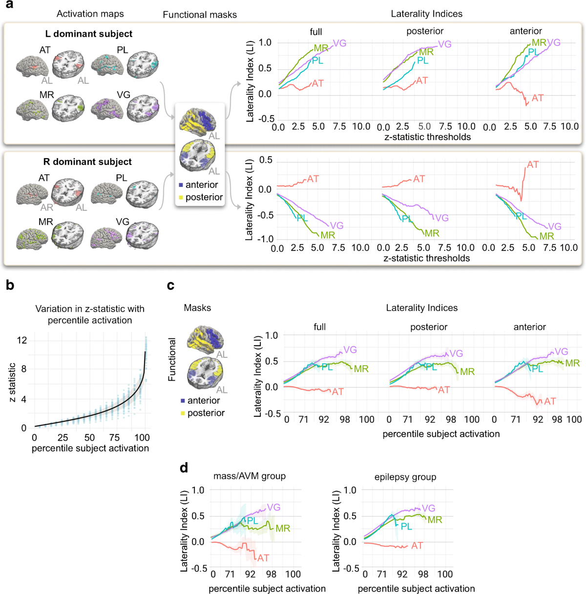 A quantitative approach for measuring laterality in clinical fMRI for  preoperative language mapping | Neuroradiology