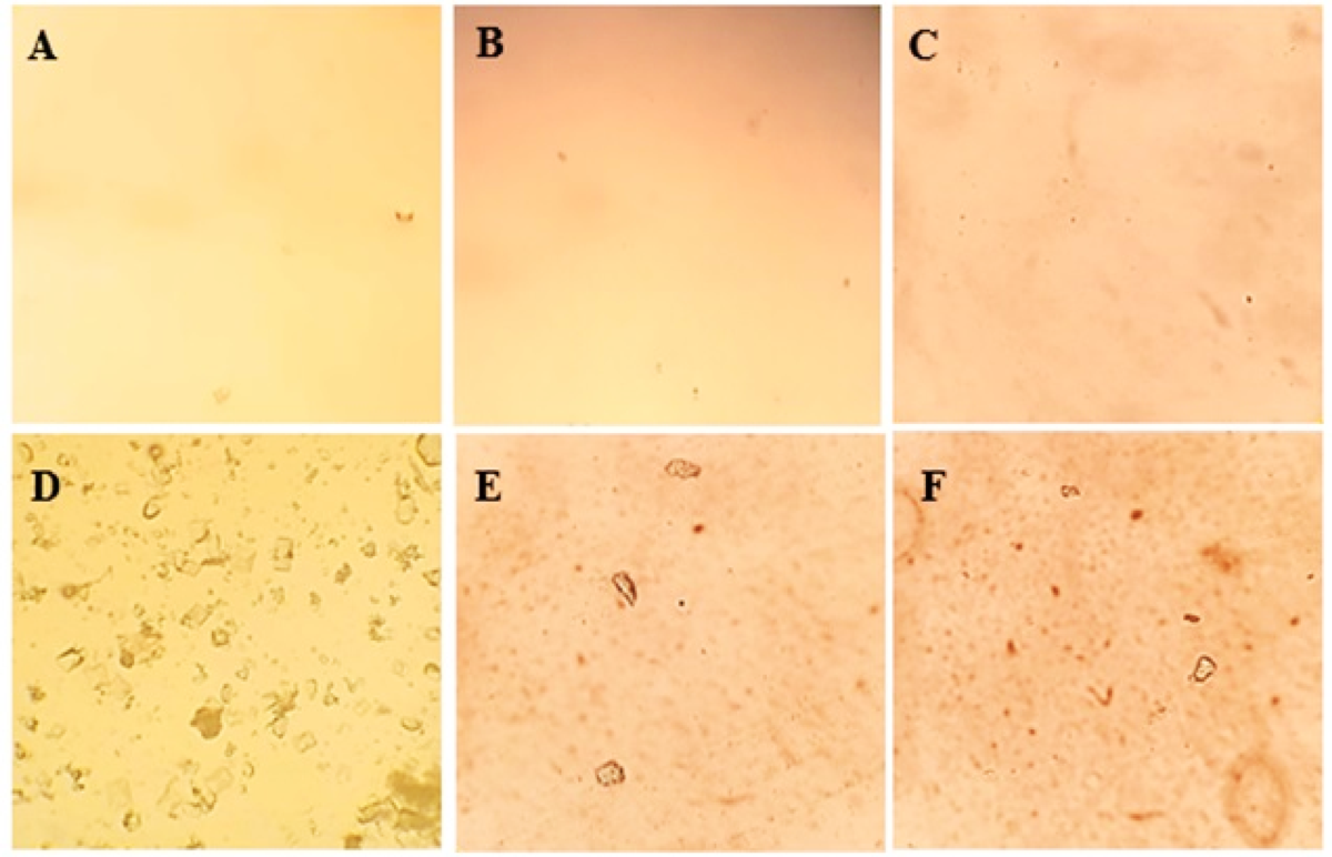 lipo b-c pills yellow urine Moroccan Pinus pinaster bark as a dual in vivo and in silico  nephroprotective agent against nephrocalcinosis: toxicity and ADMET  insights | Urolithiasis