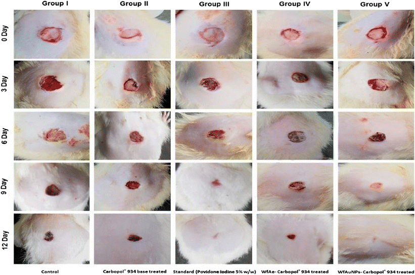colloidal silver wound dressing Wound healing applications of biogenic colloidal silver and gold  nanoparticles: recent trends and future prospects | Applied Microbiology  and Biotechnology