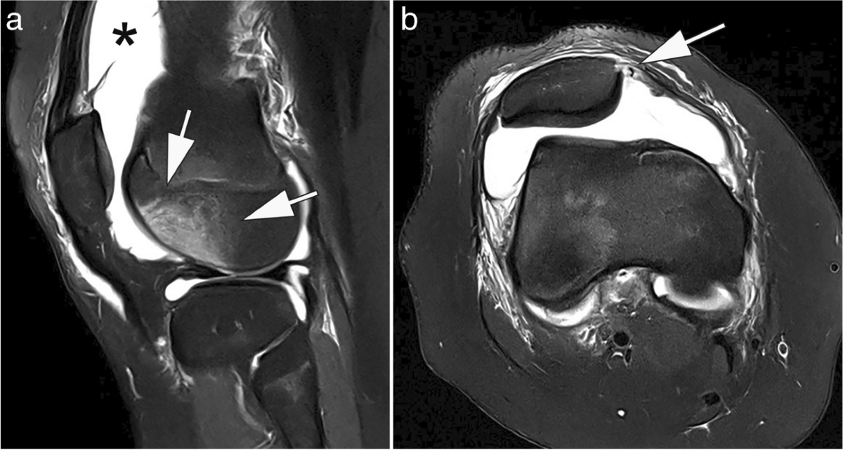 Modern low-field MRI | Skeletal Radiology