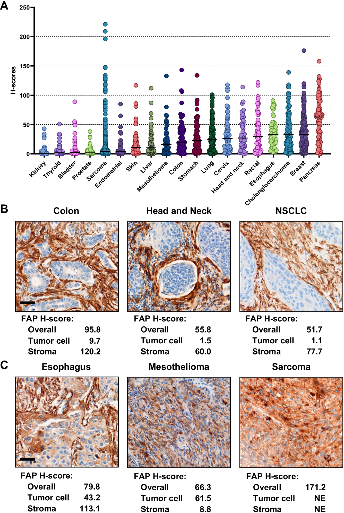LS Models nude fap Preclinical evaluation of FAP-2286 for fibroblast activation protein  targeted radionuclide imaging and therapy | European Journal of Nuclear  Medicine and Molecular Imaging