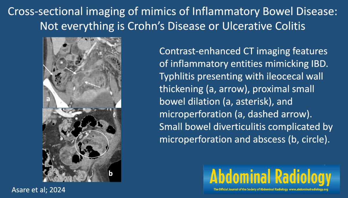 Cross-sectional imaging of mimics of inflammatory bowel disease 