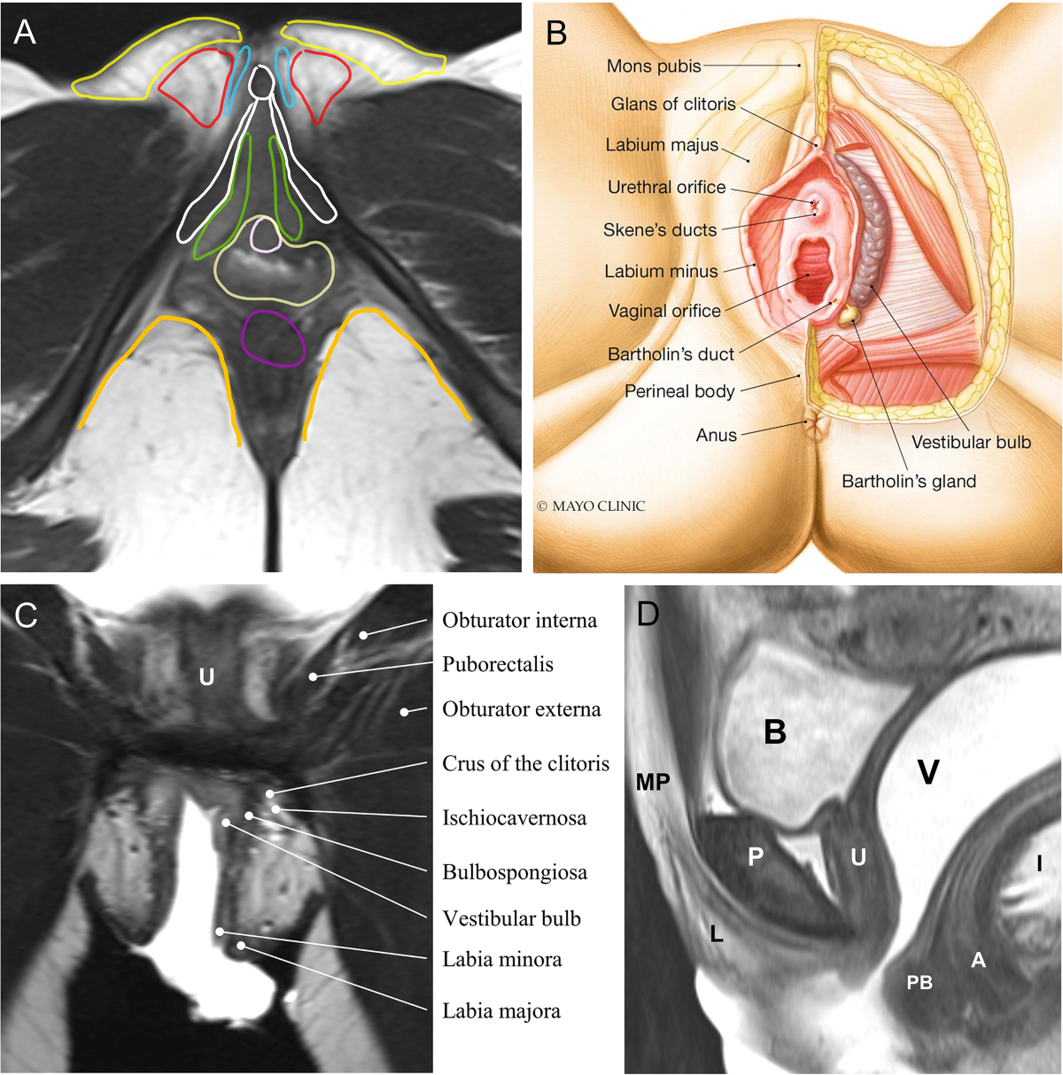 Bartholin Duct Cyst and Gland Abscess: Office Management | AAFP, image size:1200x1214