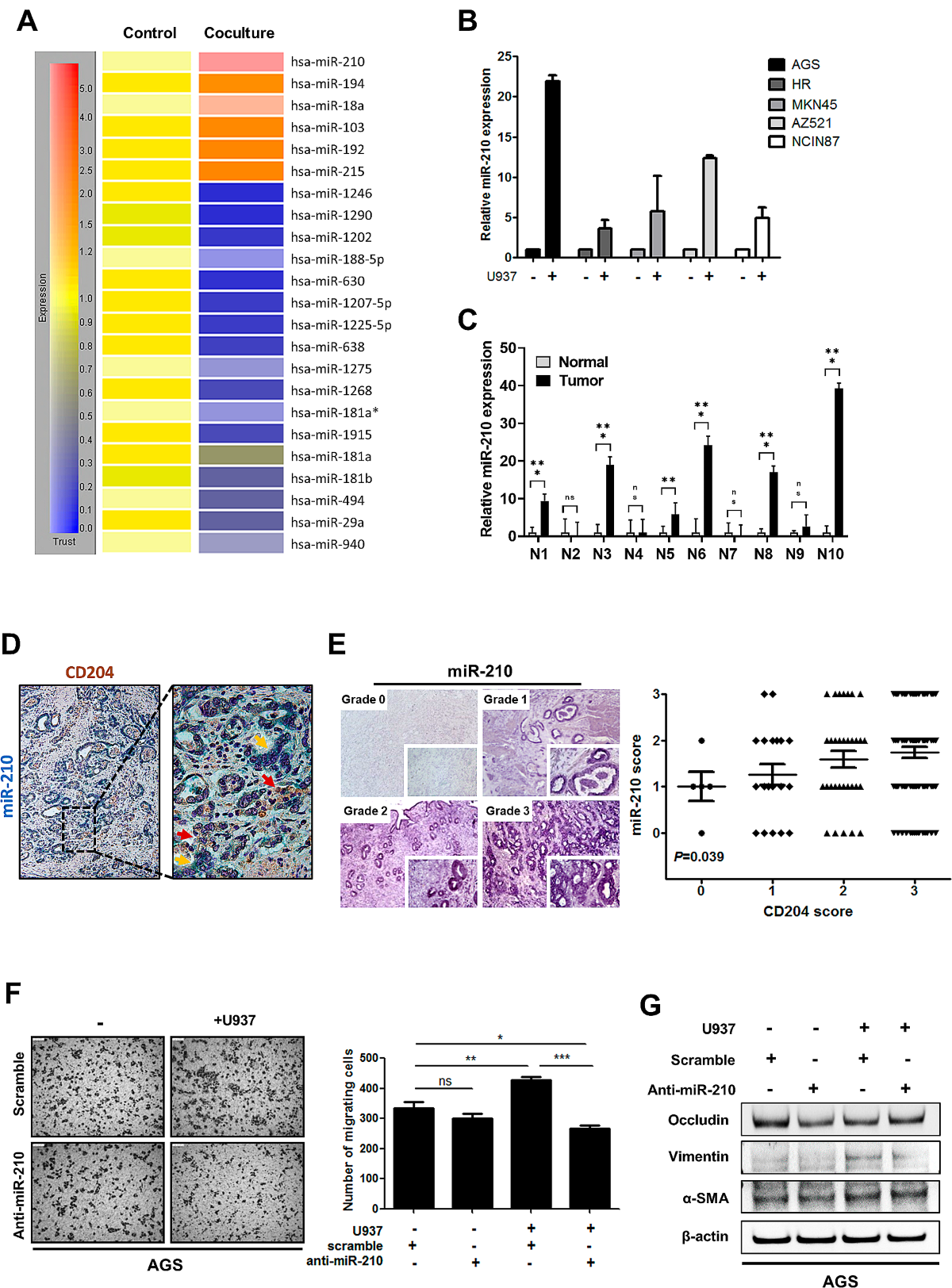 CD204-positive M2-like tumor-associated macrophages increase migration of  gastric cancer cells by upregulating miR-210 to reduce NTN4 expression |  Cancer Immunology, Immunotherapy
