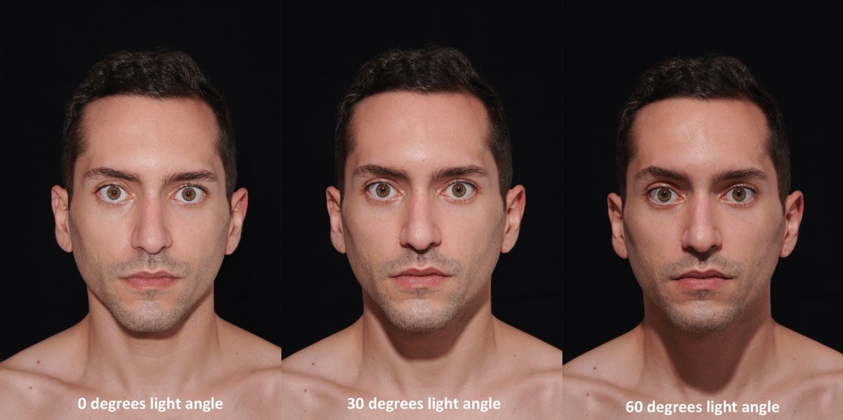 https://media.springernature.com/lw1200/springer-static/image/art%3A10.1007%2Fs00266-021-02314-3/MediaObjects/266_2021_2314_Fig2_HTML.jpg