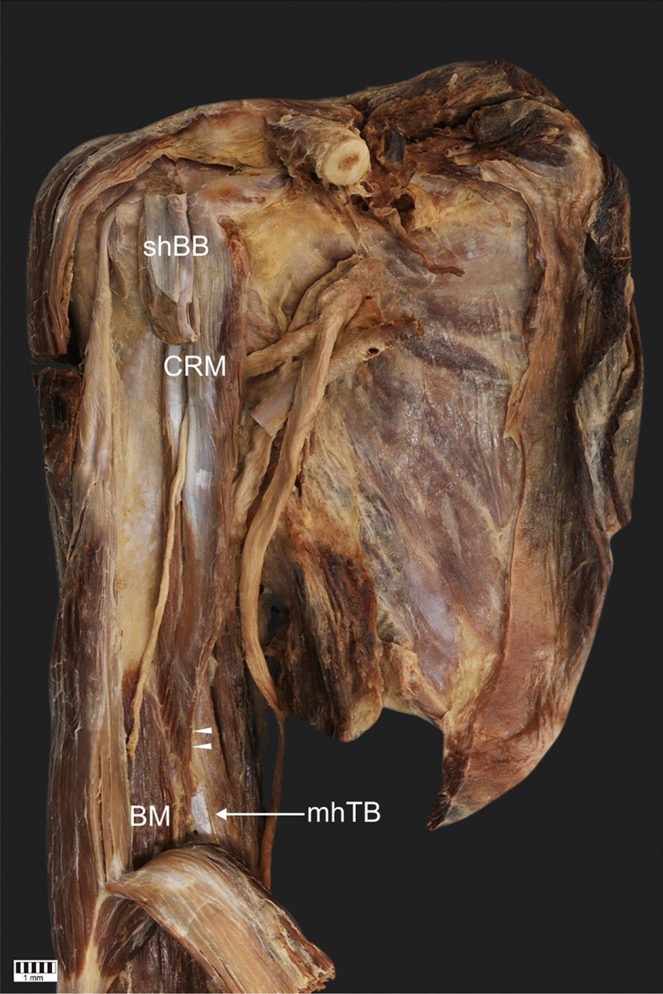 Appendicular Muscles - SLCC Anatomy, image size:967x1451