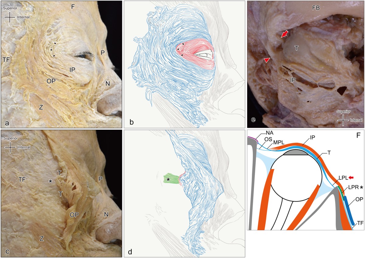 Orbicularis Oris Muscle (Anterolateral View) - Artomedics Studio, image size:1200x846