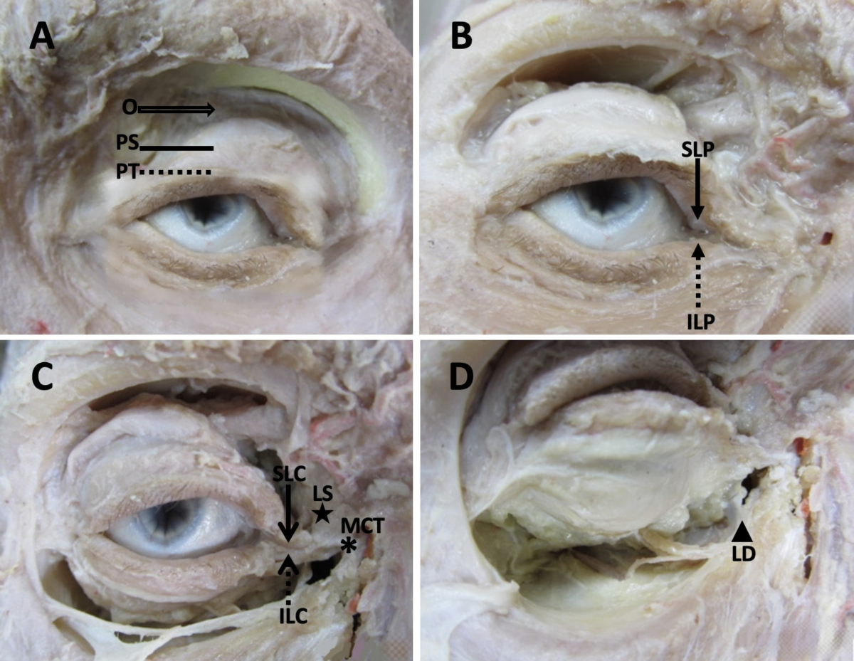 62 Lacrimal Stock Illustrations | DepositPhotos, image size:1200x929