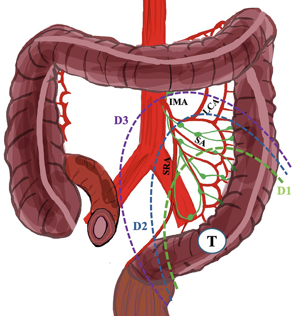 Superior Mesenteric Vein: Anatomy, Location \u0026 Function, image size:969x1033