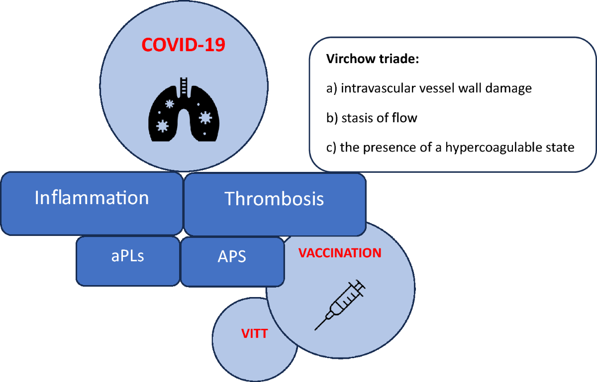 Antiphospholipid syndrome, thrombosis, and vaccination in the COVID-19 pandemic | Rheumatology International antiphospholipid-syndrome-thrombosis-and-vaccination-in-the-covid-19-pandemic-rheumatology-international
