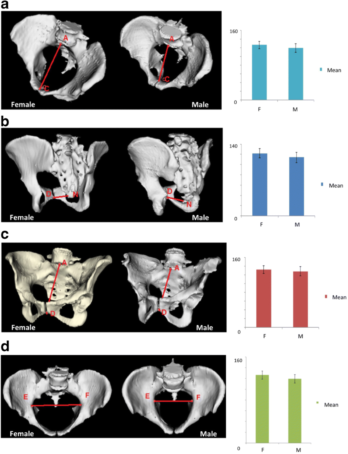 ➢ Mark and mention boundaries of pelvic inlet ➢ Differentiate between true  and false pelvis, image size:1200x1563
