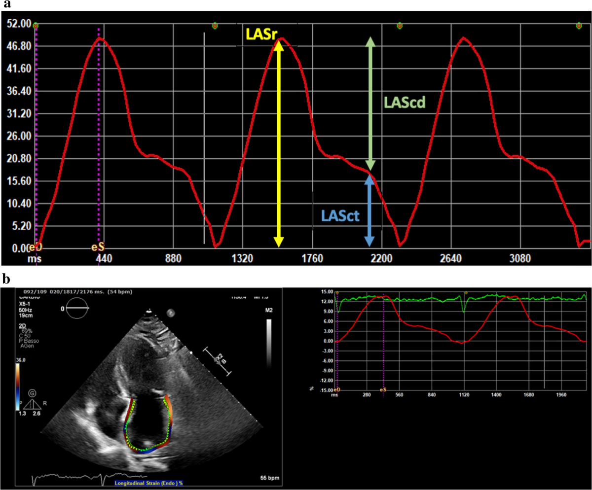 Cryptogenic stroke, left atrial function, and atrial fibrillation: a  complex relationship | Clinical Research in Cardiology