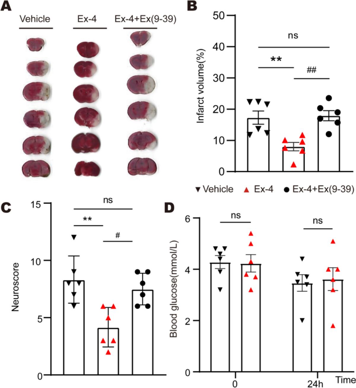 Exendin-4 improves cerebral ischemia by relaxing microvessels, rapidly  increasing cerebral blood flow after reperfusion | Basic Research in  Cardiology | Springer Nature Link