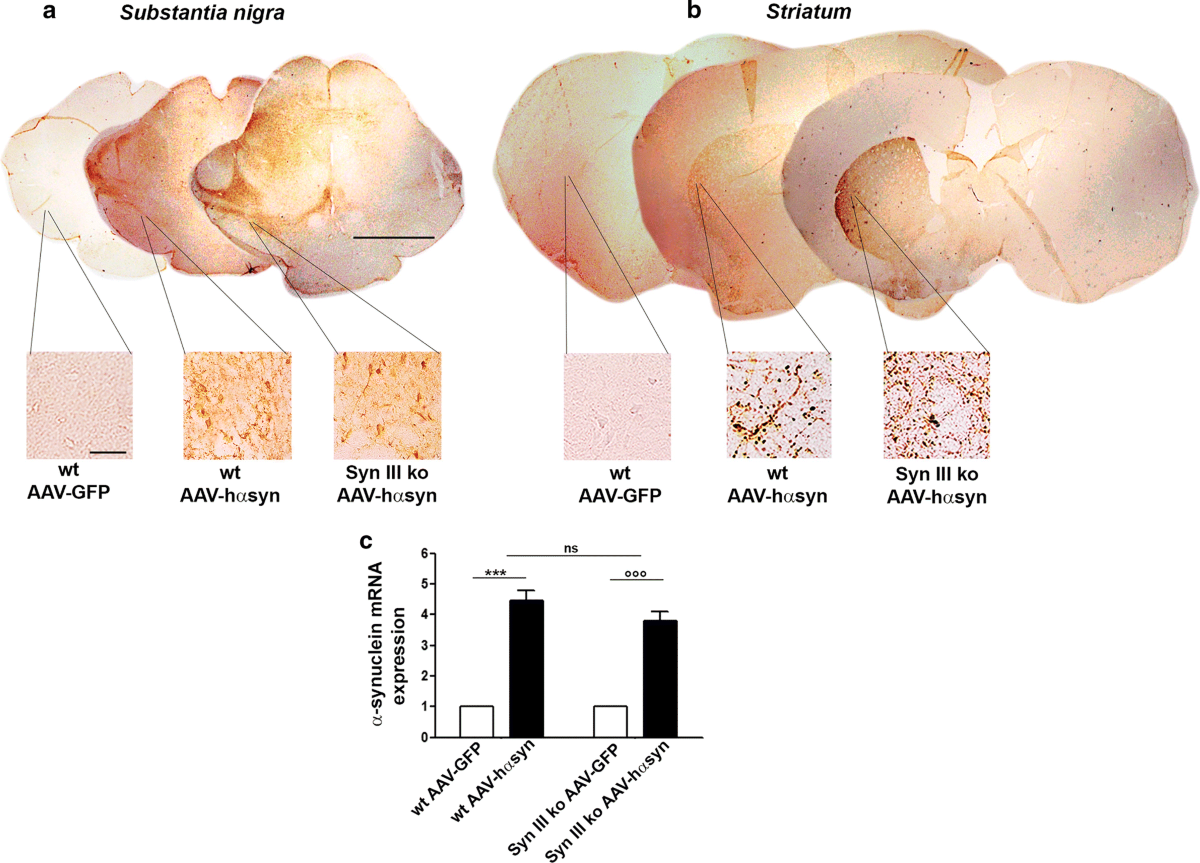 Frontiers | DMT1 Expression and Iron Levels at the Crossroads Between Aging  and Neurodegeneration, image size:1200x863