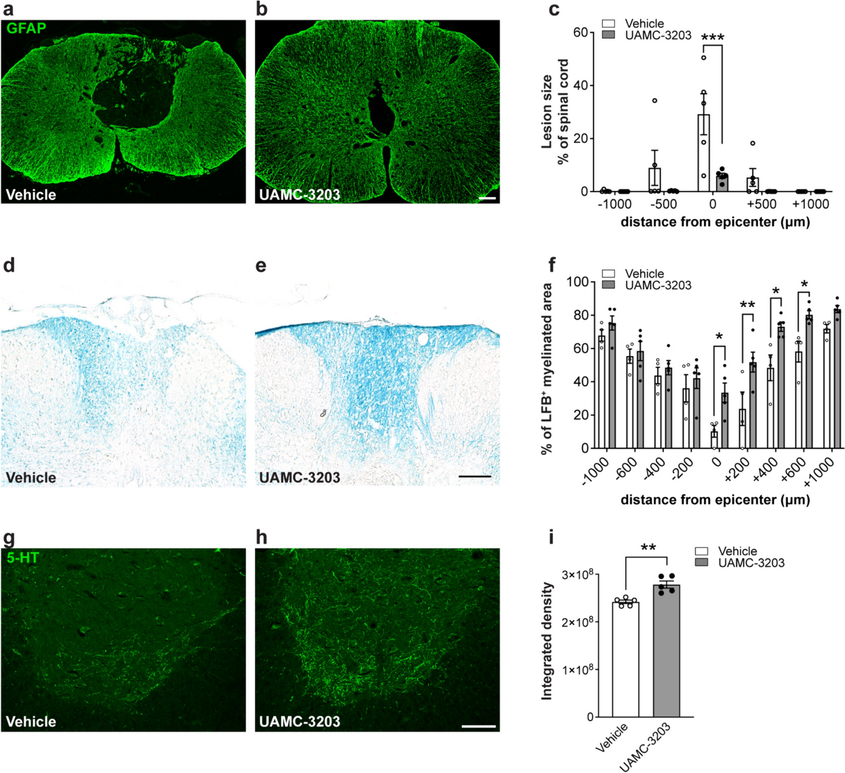 importance of glutathione in toxicity Glutathione Homeostasis and Functions: Potential Targets for Medical  Interventions - Lushchak - 2012 - Journal of Amino Acids