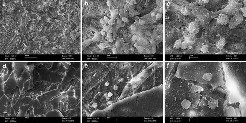 Biocompatibility evaluation of cigarette and carbon papers used in repair  of traumatic tympanic membrane perforations: experimental study | European  Archives of Oto-Rhino-Laryngology