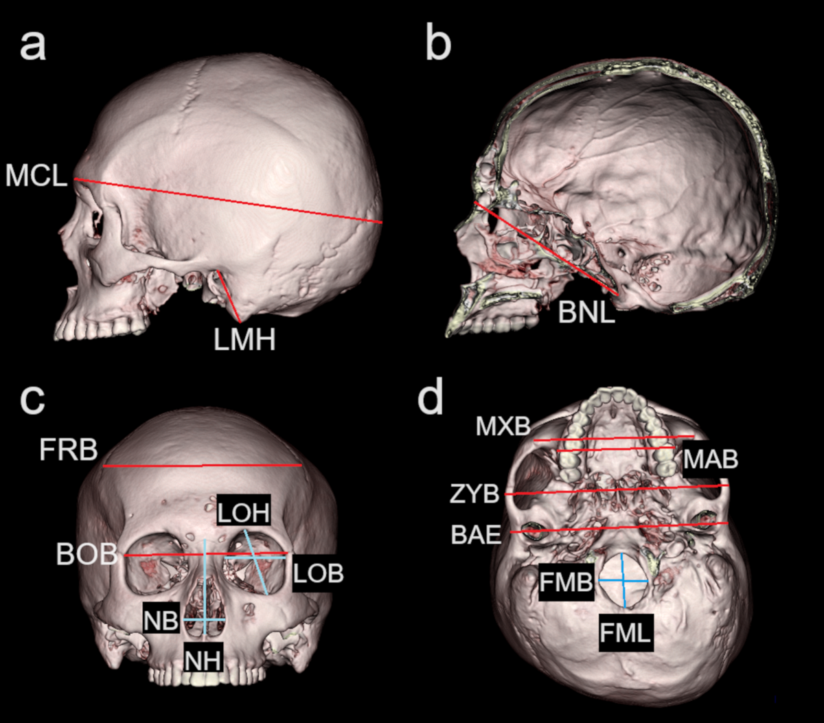 Estimation of population affinity using cranial measurements 