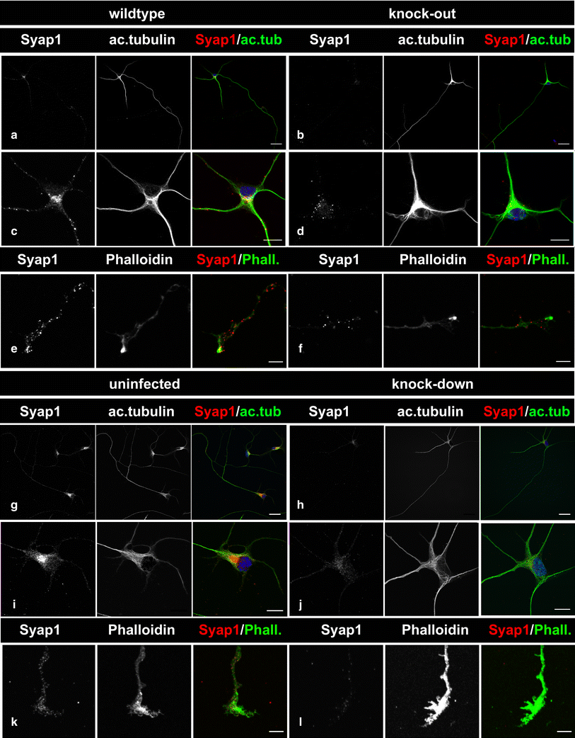 Initial characterization of a Syap1 knock-out mouse and distribution of  Syap1 in mouse brain and cultured motoneurons | Histochemistry and Cell  Biology
