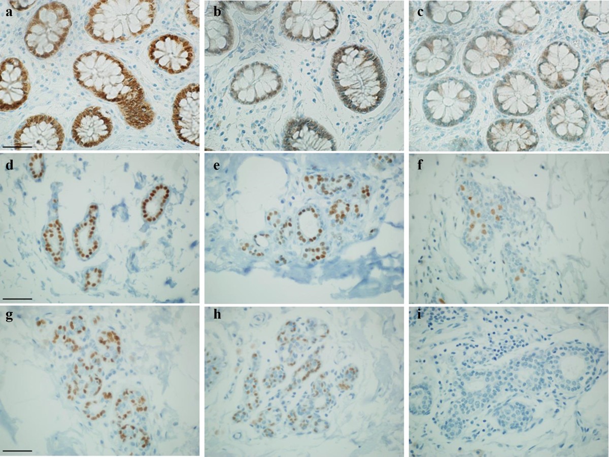 Coping with formalin banning in pathology: under vacuum long-term tissue  storage with no added formalin | Histochemistry and Cell Biology