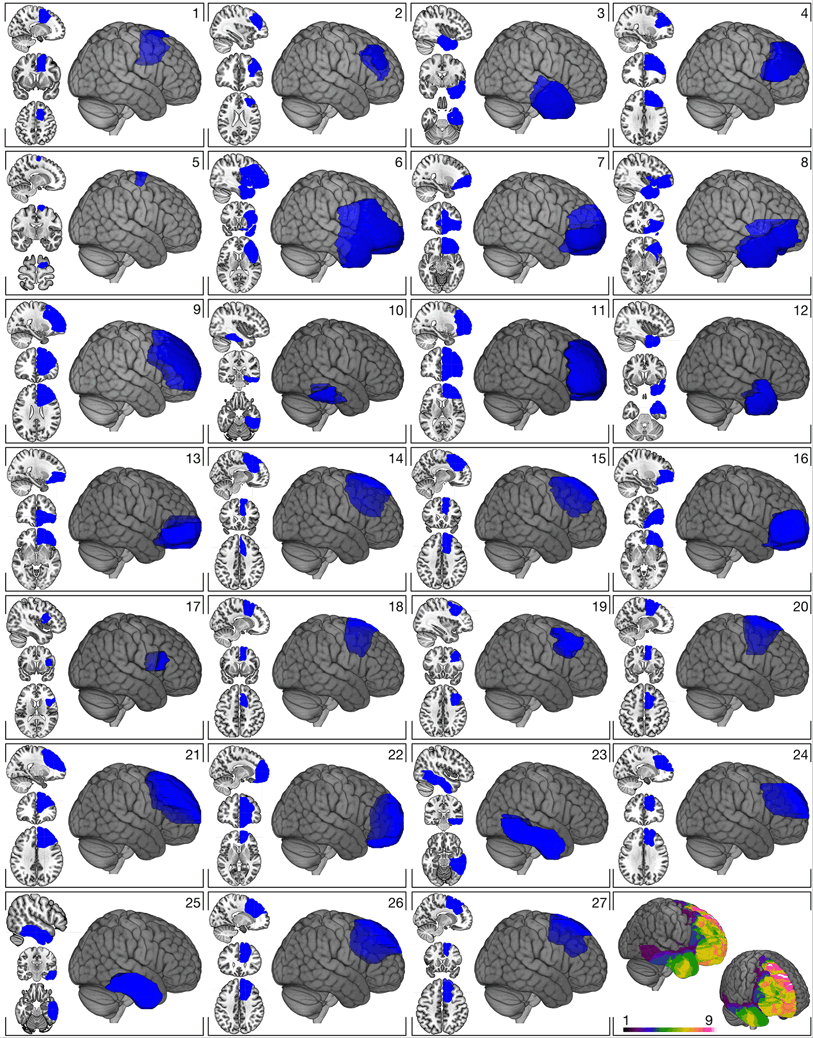 Neural pathways subserving face-based mentalizing | Brain Structure and  Function