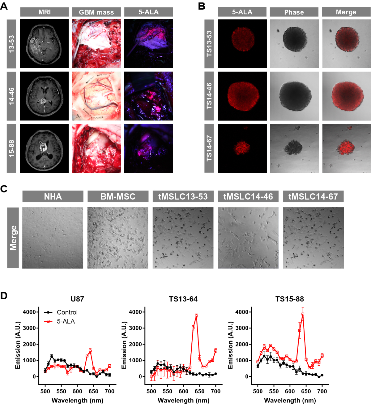 C5α secreted by tumor mesenchymal stem-like cells mediates resistance to  5-aminolevulinic acid-based photodynamic therapy against glioblastoma  tumorspheres | Journal of Cancer Research and Clinical Oncology