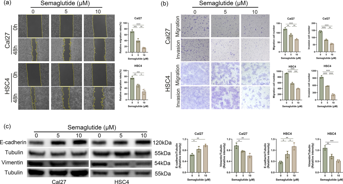 semaglutide and wound healing Semaglutide, a glucagon-like peptide-1 receptor agonist, inhibits oral squamous cell carcinoma growth through P38 MAPK signaling pathway | Journal of Cancer Research and Clinical Oncology semaglutide and wound healing Semaglutide, a glucagon-like peptide-1 receptor agonist, inhibits oral squamous cell carcinoma growth through P38 MAPK signaling pathway | Journal of Cancer Research and Clinical Oncology