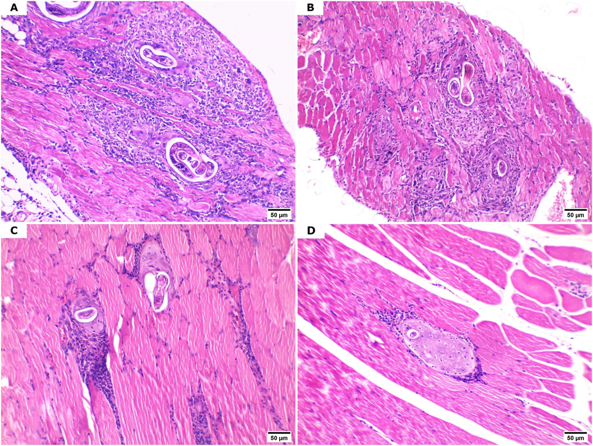 Immunomodulatory and anti-inflammatory effects of fluvoxamine during the  intestinal phase of Trichinella spiralis infection in mice | Parasitology  Research | Springer Nature Link