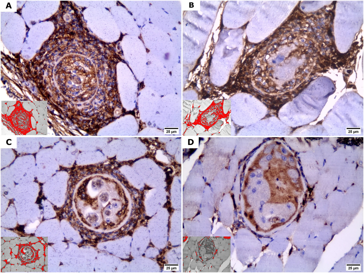 Immunomodulatory and anti-inflammatory effects of fluvoxamine during the  intestinal phase of Trichinella spiralis infection in mice | Parasitology  Research | Springer Nature Link