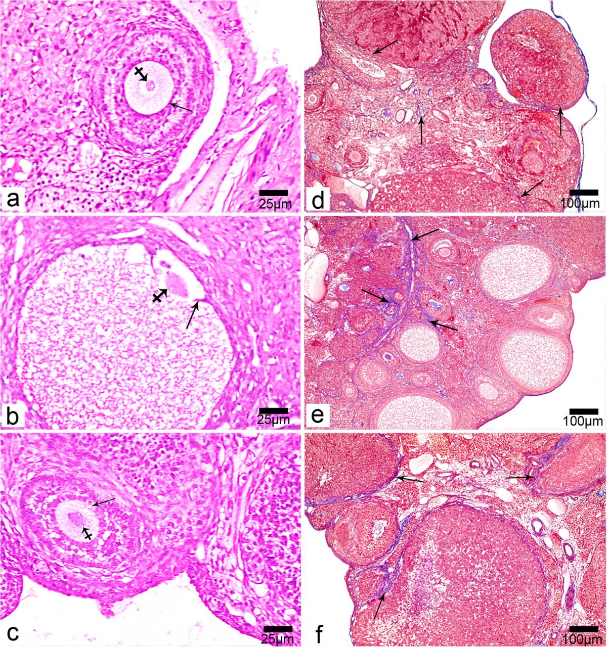 is glutathione good for ovarian cyst The role of oxidative stress in ovarian toxicity induced by haloperidol and  clozapine—a histological and biochemical study in albino rats | Cell and  Tissue Research