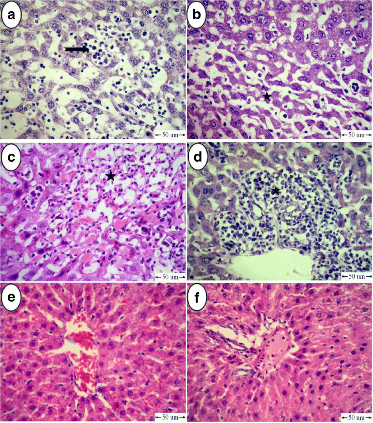 The protective role of l-carnitine against 1st- and 2nd-generation  antihistamine-induced liver injury in mice | Comparative Clinical Pathology 