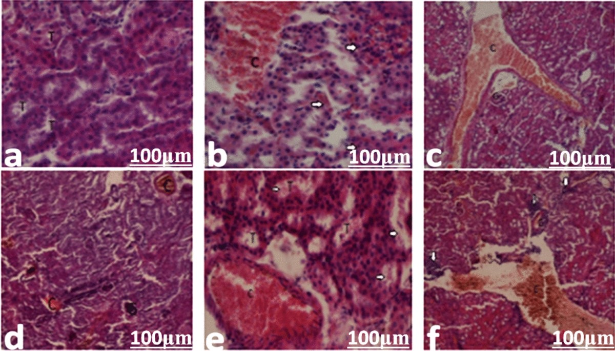 do antibiotics deplete glutathione Sequential exposure to multiple antibiotics depleted glutathione in  hepatocytes, disrupted hematological profile, and inflammatory responses in  a mouse model | Comparative Clinical Pathology
