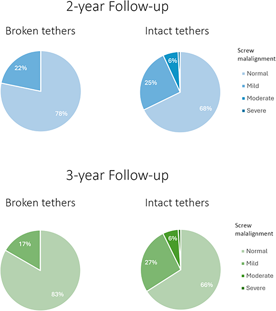 Does screw alignment affect tether breakage in vertebral body tethering? |  European Spine Journal | Springer Nature Link