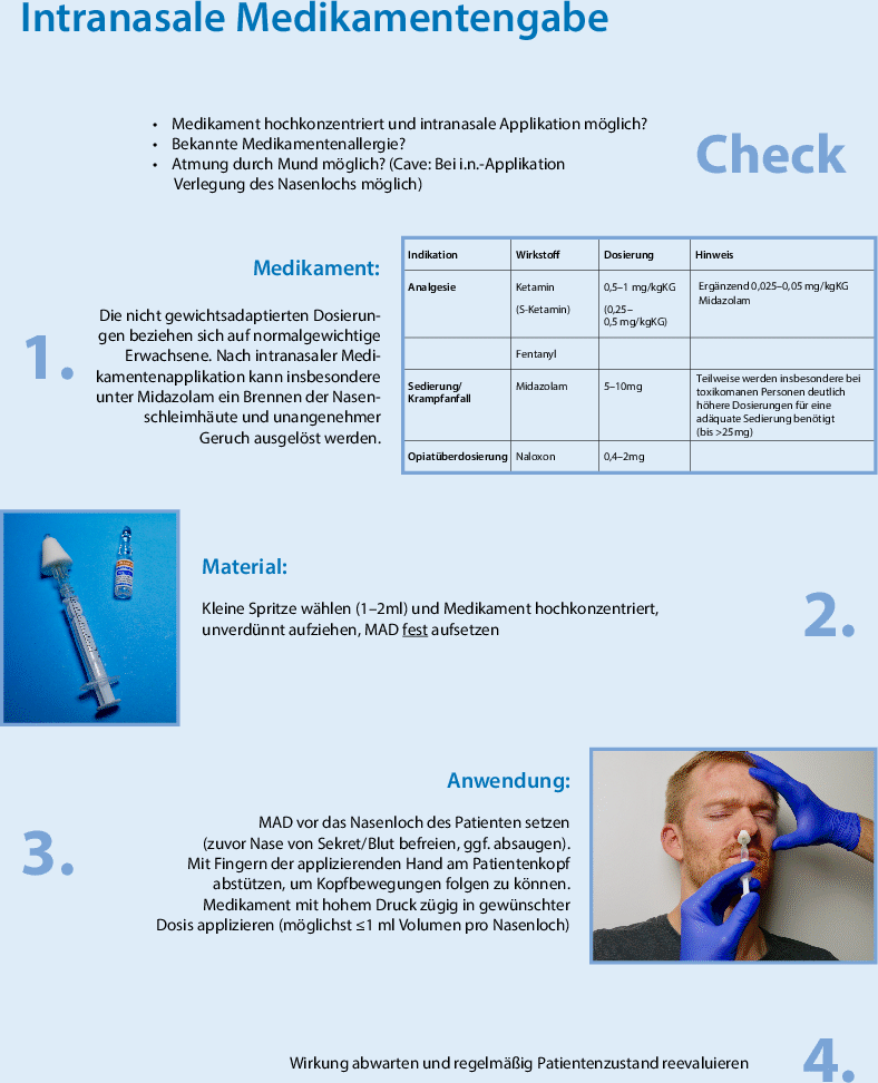Intranasale Medikamentenapplikation im Notfall | Notfall + Rettungsmedizin | Springer Nature Link Intranasale Medikamentenapplikation im Notfall | Notfall + Rettungsmedizin | Springer Nature Link