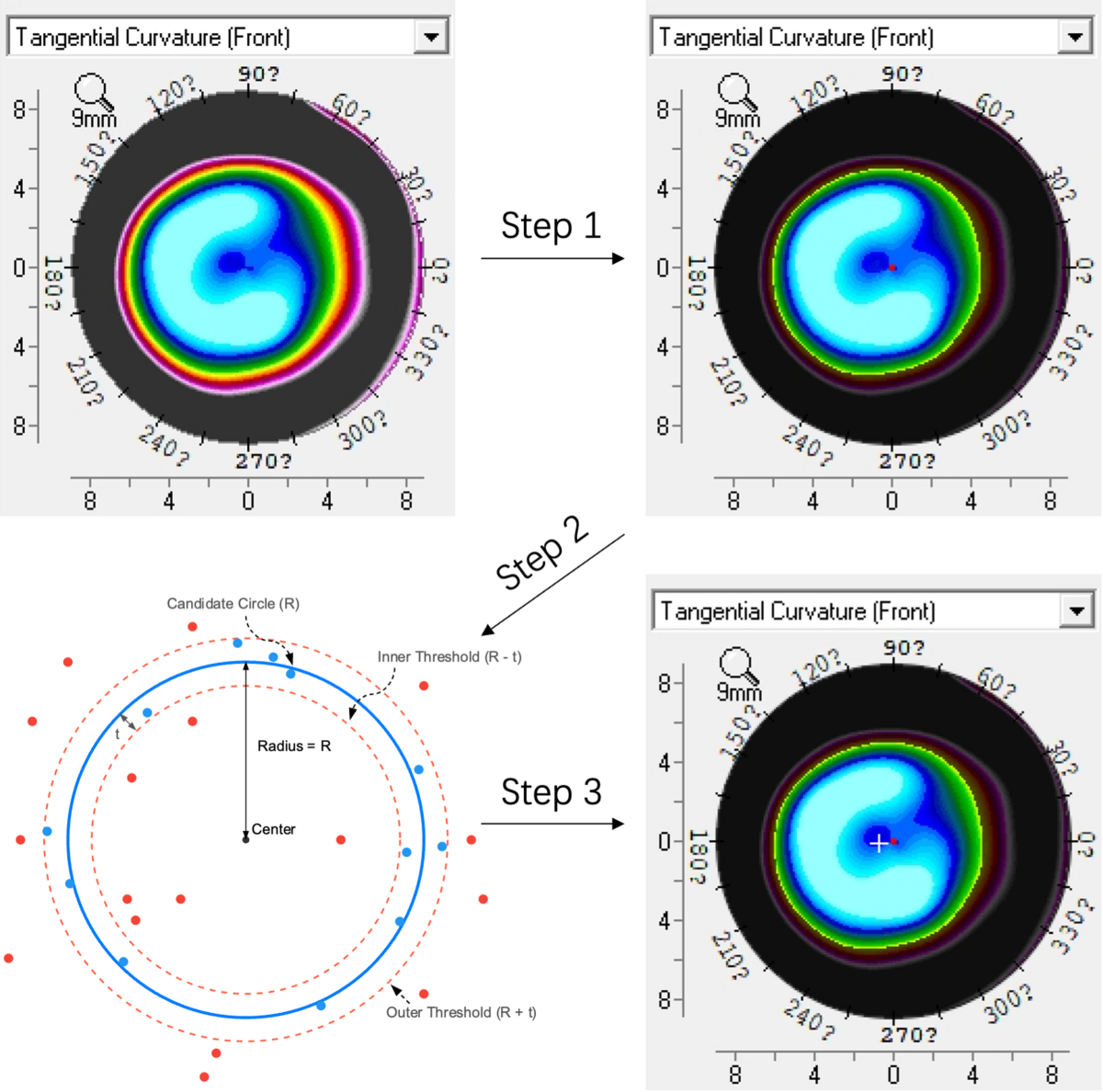 Ten year outcomes of effective optical zone and decentration  