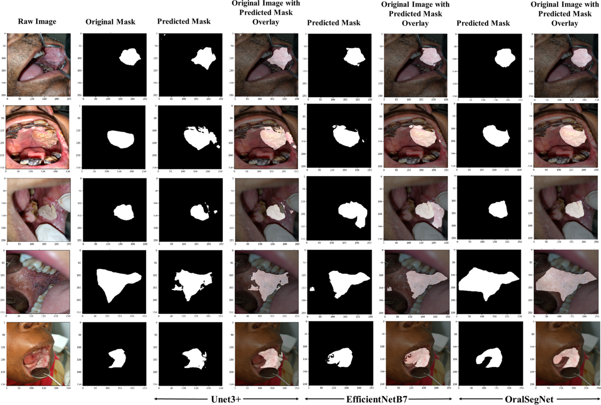 "lsm.jpg4.us | imagesize: ism-011 Smartphone-Based Oral Lesion Image Segmentation Using Deep Learning |  Journal of Imaging Informatics in Medicine
