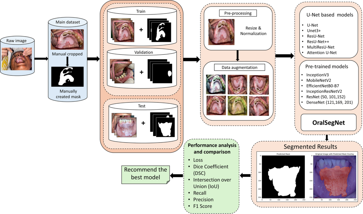 "lsm.jpg4.us | imagesize: ism-011 Smartphone-Based Oral Lesion Image Segmentation Using Deep Learning |  Journal of Imaging Informatics in Medicine