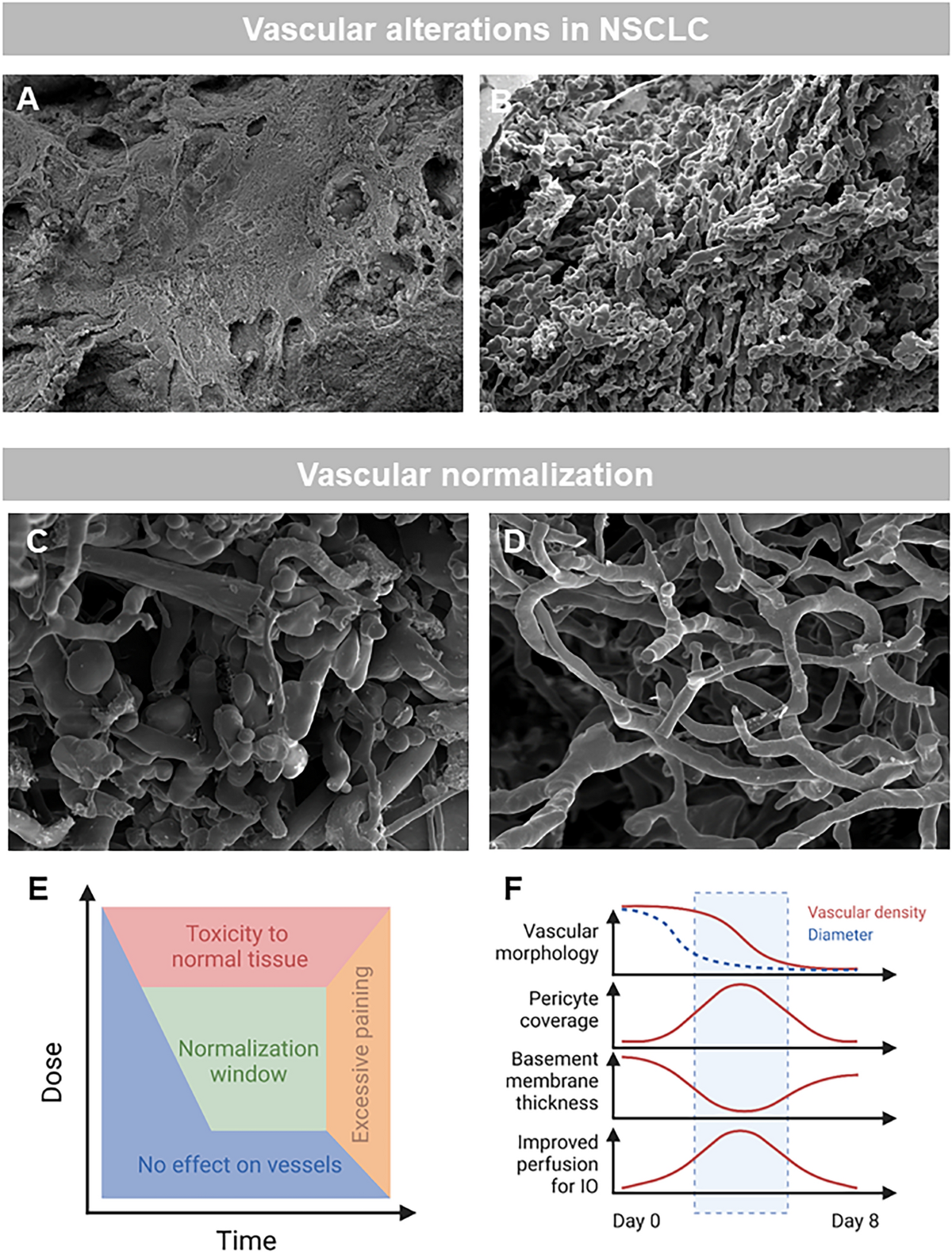 The role of vasculature and angiogenesis in respiratory diseases |  Angiogenesis