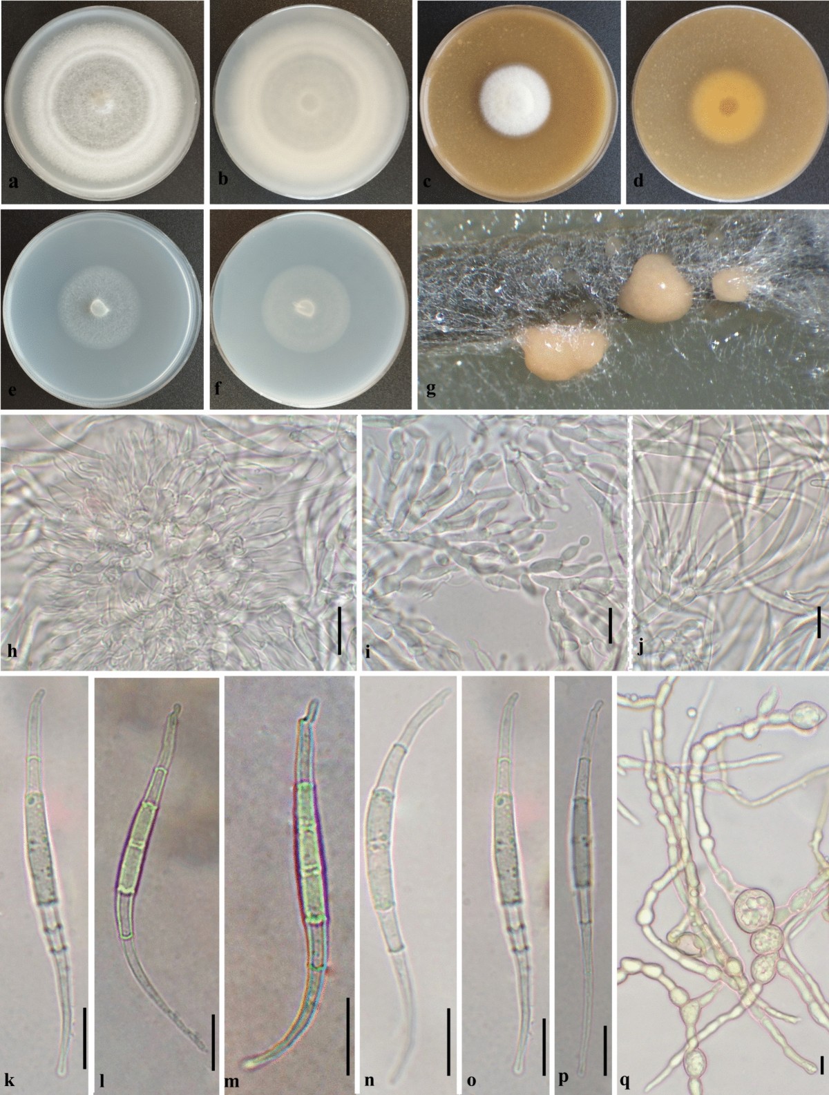 Two new species of Fusarium in the F. incarnatum-equiseti species complex  from Oryza sativa in Iran | Antonie van Leeuwenhoek