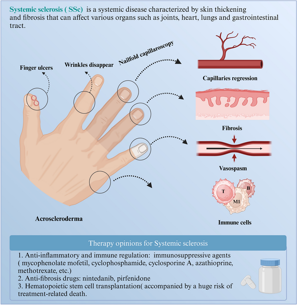 The complexities of cell death mechanisms: a new perspective in systemic sclerosis therapy | Apoptosis