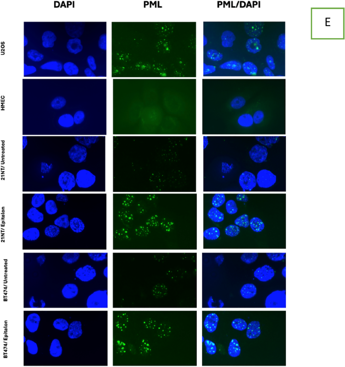 Epitalon increases telomere length in human cell lines through telomerase upregulation or ALT activity | Biogerontology | Springer Nature Link Epitalon increases telomere length in human cell lines through telomerase upregulation or ALT activity | Biogerontology | Springer Nature Link