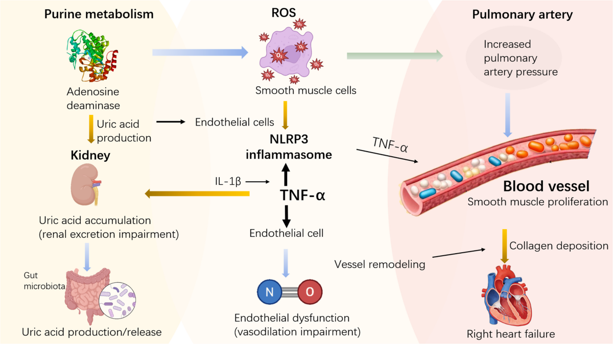 Hyperuricemia and Hypoxic Pulmonary Hypertension: Pathogenic Links, Clinical Evidence, and Emerging Therapeutic Insights | Cardiovascular Drugs and Therapy