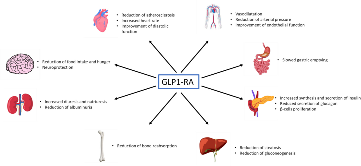 glp 1 agonists and inflammation GLP-1 receptor agonists as promising anti-inflammatory agents in heart  failure with preserved ejection fraction | Heart Failure Reviews