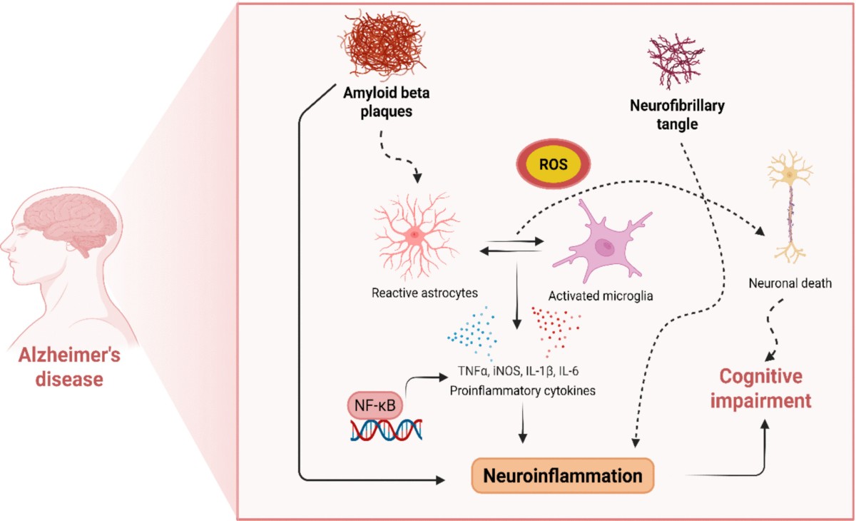 glutathione and enbrel Selective Inhibition of Tumor Necrosis Factor for Attenuating Alzheimer's  Disease: Strategies Targeting Neuroinflammation | Inflammation
