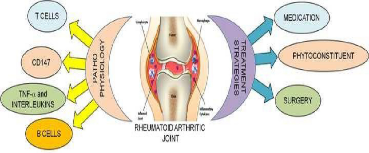 glutathione iv for rheumatoid arthritis Pathophysiology, diagnosis, and herbal medicine-based therapeutic  implication of rheumatoid arthritis: an overview | Inflammopharmacology