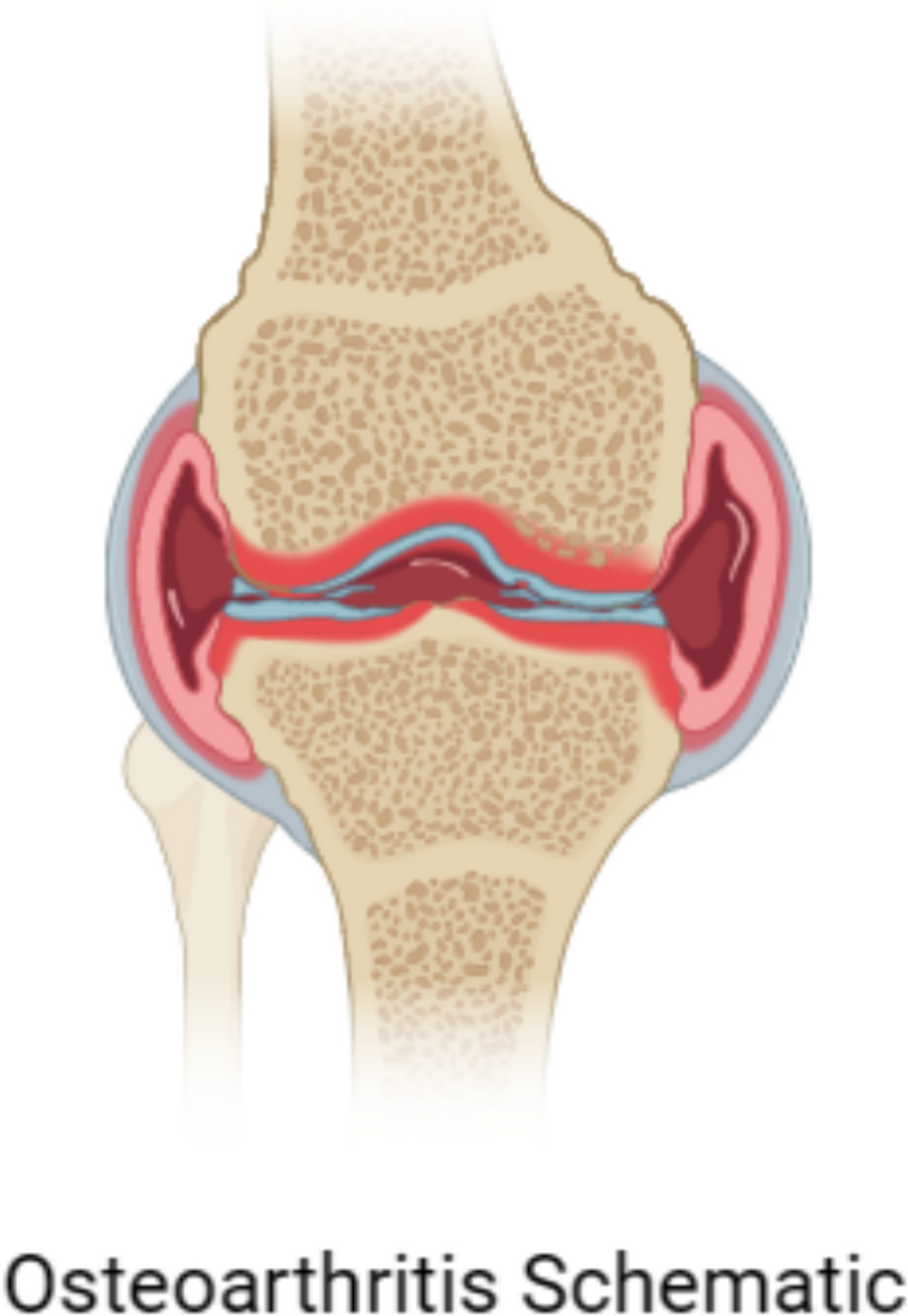ASU Powder Help With Joint Pain And Osteoarthritis
